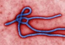 Ebola: How Nigerians Can Prevent Infection